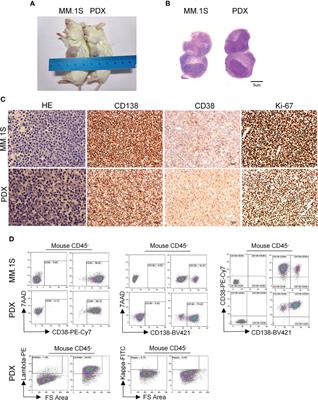 Novel myeloma patient-derived xenograft models unveil the potency of anlotinib to overcome bortezomib resistance